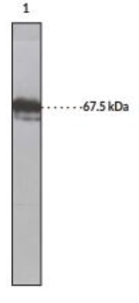 SDS-PAGE (FAAH-19H).jpg